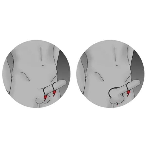 Prestige Electra Loops Verstellbare Cockringe Rot von Electrastim | Fesselliebe.de